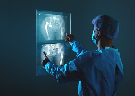 Fotografía de un doctor viendo una radiografía